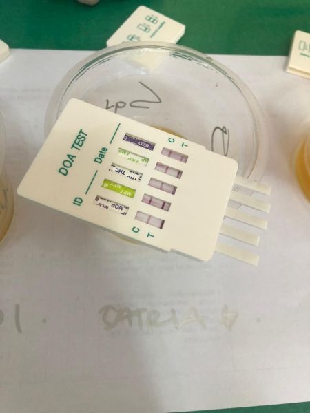 Contoh hasil tes Urine