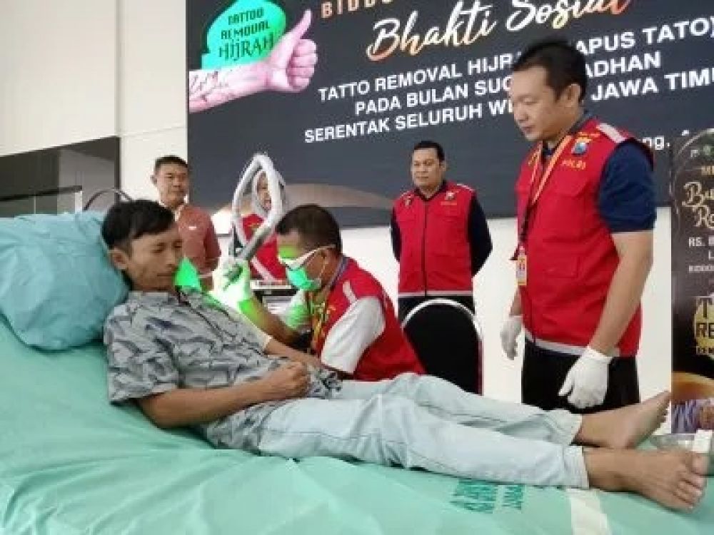 Polda Jatim gelar program hapus Tato gratis